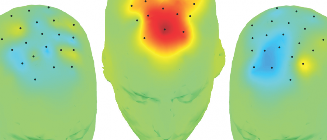 A human prefrontal-subthalamic circuit for cognitive control