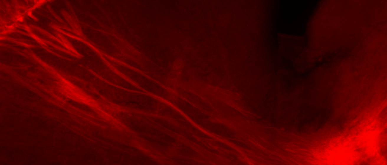 MFC D1 Neuronal Projection